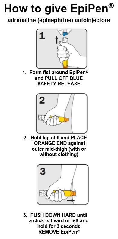Anaphylaxis (Severe Allergic Reaction)
